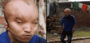 Inde : Un Homme À La Tête « D’alien » Recherche L’amour (Photos)