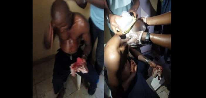 Nigeria : Un Arbitre Battu Sans Pitié Après Un Match (Photos)