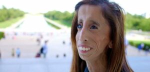 7 Citations De Lizzie Velasquez “La Femme La Plus Laide Du Monde