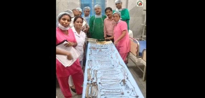 Inde: des médecins retirent 1,6 kg de bijoux de l’estomac d’une femme de 26 ans (vidéo)