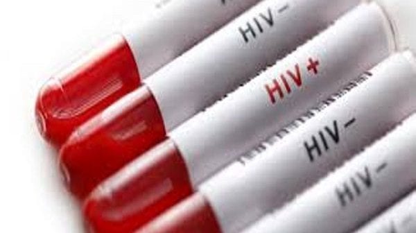 Kenya : Le premier gel vaginal anti-VIH entre en phase d’essai