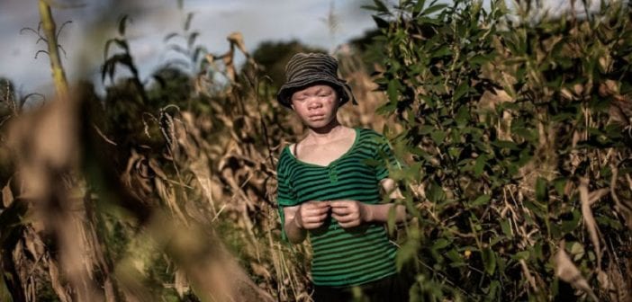 Malawi-crime rituel: 3 personnes condamnées à mort pour le meurtre d’un albinos