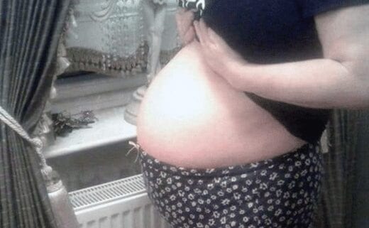 o 20 - Son ventre fait croire qu'elle était enceinte, la suite est triste