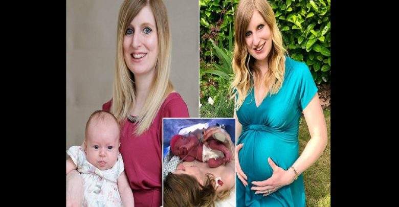 Une Femme Née Avec Deux Vagins Et Deux Utérus Met Au Monde Un Bébé