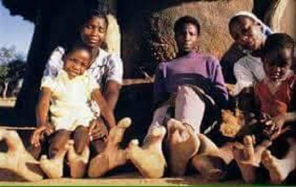 La Tribu Vadoma Du Zimbabwe N’a Que Deux Orteils À Chaque Pied