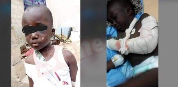 Enfant torturé Sénégal Les révélations affligeantes maman - Enfant torturé au Sénégal : Les révélations affligeantes de sa maman