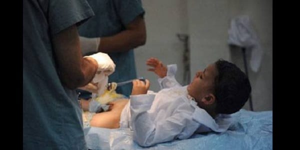 Erreur Médical: Un Chirurgien Ampute Le Pénis D’un Enfant De 3 Ans Lors D’une Circoncision