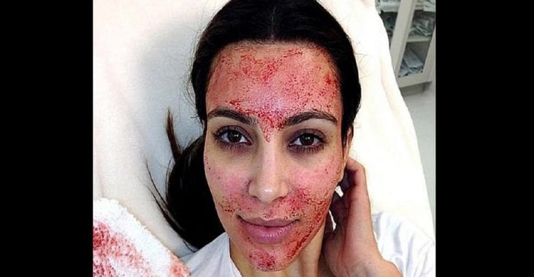 Kim Kardashian Intenteprocès Médecin Esthétique
