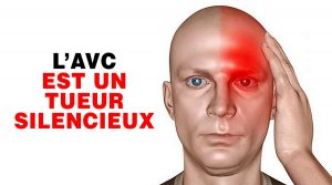 8 Symptômes Étranges Que Vous Avez Eu Un Avc Silencieux Et Qu’un Autre Pourra Bientôt Suivre