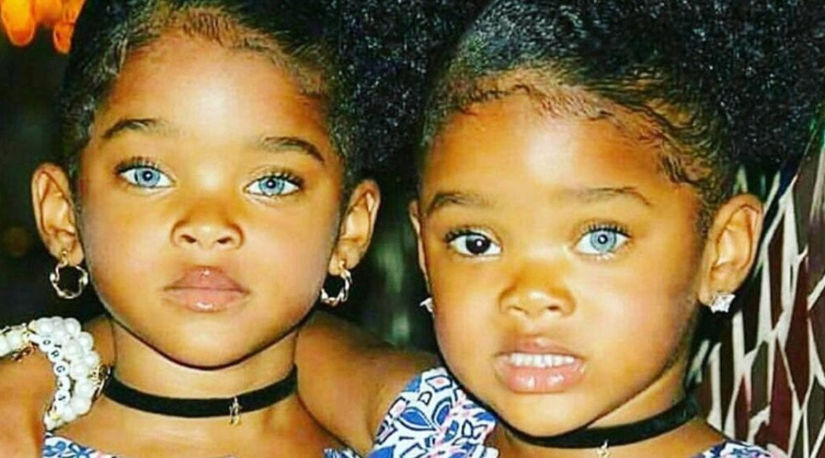 Ces jumelles noires de peau yeux bleus a attiré l’admiration de milliers d’internautes internet il y a 8 ans les revoici aujourd’hui  - Ces jumelles noires de peau aux yeux bleus avaient attiré l’admiration de milliers d’internautes sur internet il y a 8 ans, les revoici aujourd’hui !