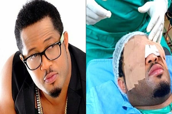 L’acteur nigérian Mike Ezuruonye a subi une chirurgie des yeuxphoto - L’acteur nigérian Mike Ezuruonye a subi une chirurgie des yeux (photo)