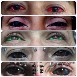 Une Dangereuse Pratique Venue Des Usa Prend Ampleur, Le Tatouage Des Yeux