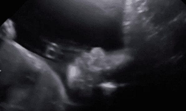 ventre de maman ce bébé fait coucouVIDEO - Dans le ventre de maman, ce bébé fait coucou (VIDEO)