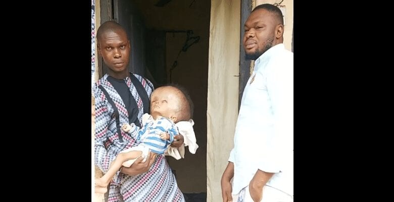 Nigeria : Il Refuse Une Transfusion Sanguine Pour Son Enfant Malade À Cause De Ses Convictions Religieuses (Vidéo)