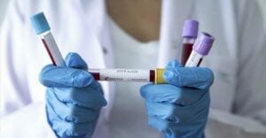 Santé: Premier Cas De Coronavirus Confirmé Au Nigeria