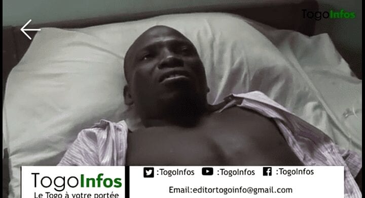 Togo : Voici Une Victime Des Bavures Policières Sur Son Lit D’hôpital