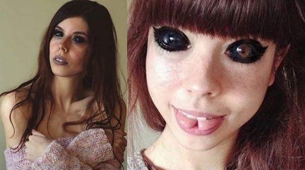 Aleksandra, 25 Ans, Se Fait Tatouer Le Blanc De Ses Yeux Et Perd La Vue
