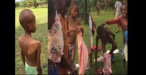 Nigeria : Une Fille De 13 Ans Enfermée Et Torturée Par Sa Mère Après Qu’un Prophète A Affirmé Qu’elle Est Possédée Par Un Démon (Photos)