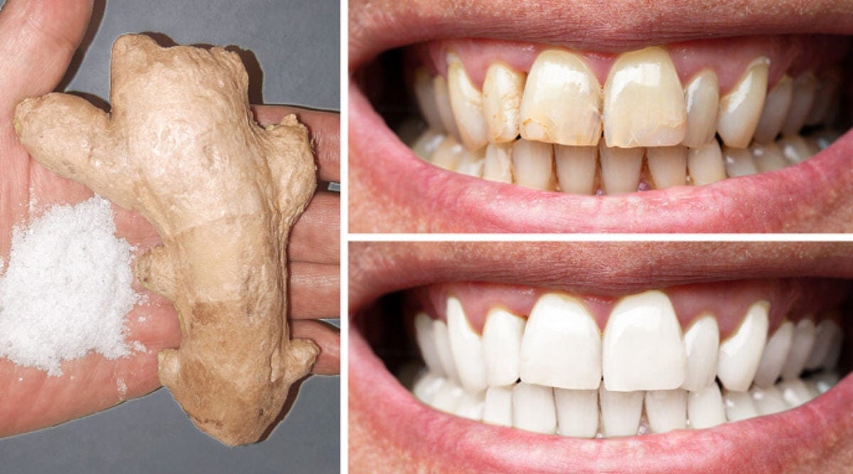 Oui, Le Gingembre Et Le Sel Permettent De Blanchir Les Dents : Voici Comment Les Utiliser