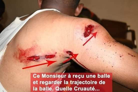 Référendum: Une Journée D’une Violence D’etat Insoutenable En Guinée