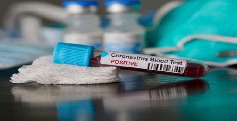 Coronavirus: 3 millions de cas confirmés dans le monde