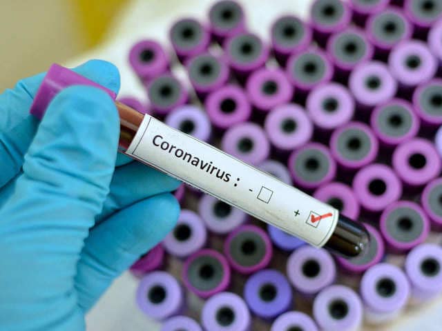Coronavirus Au Burkina 16 Nouveaux Cas Ce 4 Avril 2020 Soit 318 Confirmés