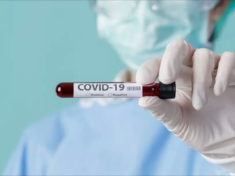 Coronavirus au Cameroun Doingbuzz - Cameroun : Des personnes porteuses du Covid-19 portées disparues