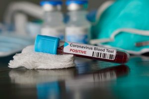 Coronavirus En  Côte D’ivoire : Un Cas Positif Porté Disparu