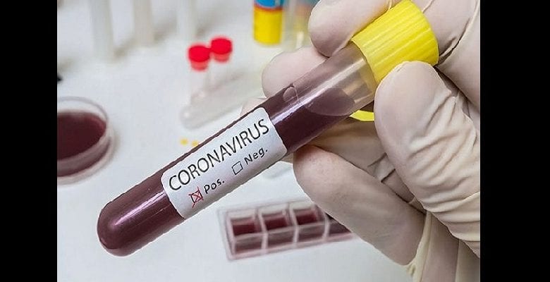 Ghana une Guinéenne testée positive coronavirus activement recherchée - Covid-19 au Togo : le bilan ce 1er avril 2020
