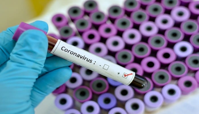 Royaume Unides Tests Coronavirus Contaminés Coronavirus