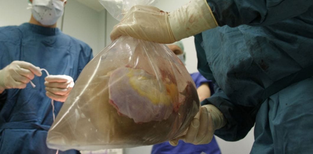 Covid-19/ France : des médecins accusés de tuer les Africains pour vendre leurs organes