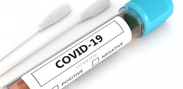 Coronavirus : C&Rsquo;Est « La » Covid-19, Selon L&Rsquo;Académie Française
