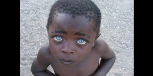 Découvrez Pourquoi Certains Africains Noirs Ont Les Yeux Bleus