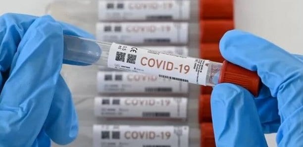 Le Coronavirus Préoccupe Aussi Les Académiciens
