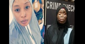 Arabie Saoudite: Une Ghanéenne Victime D’une Attaque À L’acide