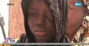 La Triste Histoire D’une Jeune Fille Qui A Perdu Un Œil Au Senegal (Video)