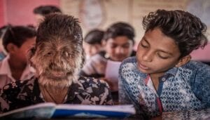 Découvrez 6 Des Enfants Les Plus Étranges Du Monde (Photos)