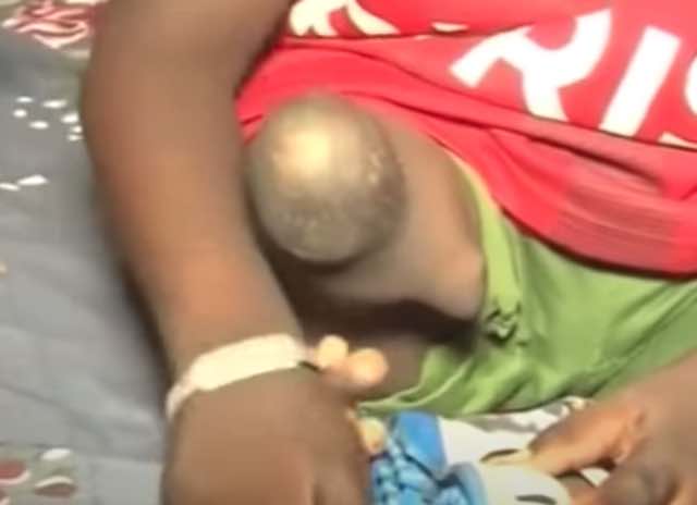 Senegal : L’histoire Très Triste De Bébé Mouhamed (3 Ans) Né Avec Une Seule Jambe