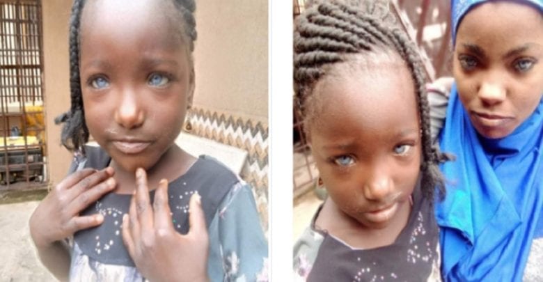 Nigeria: Un Homme Aurait Rejeté Sa Fille Parce Qu’elle A Des Yeux Bleus (Photos)