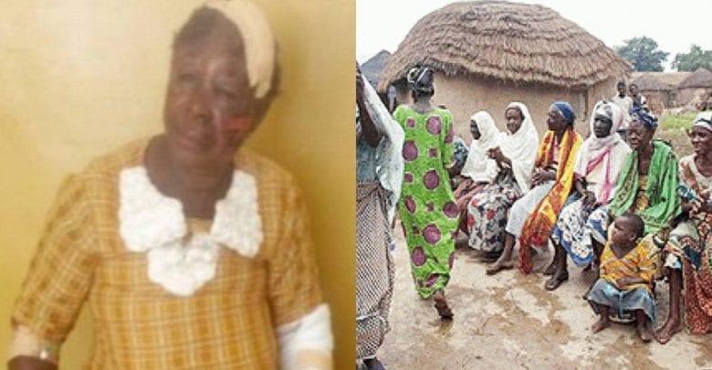 Ghana Une Vieille Femme Accusée Une Sorcière Battue Par Des Villageois