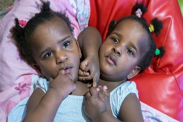 Marieme Et Ndeye: Les Sœurs Siamoises À Qui Les Docteurs Avaient Donné 4 Jours À Vivre À La Naissance Font Leur Entrée À L’école