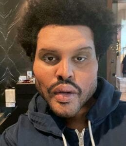 The Weeknd: La Vérité Derrière Son Nouveau Visage Immonde