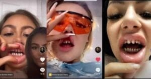 Tik Tok : Un Challenge Très Dangereux Voit Le Jour