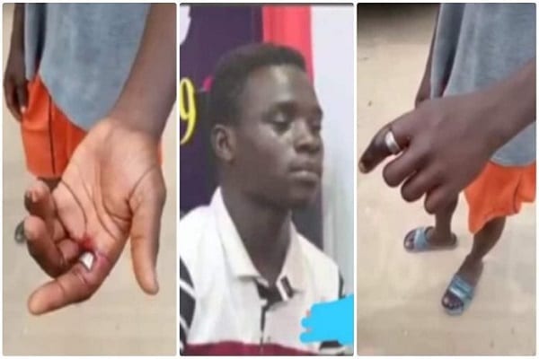 Ghana le jeune homme failli perdre son doigt après avoir porté la bague magiqueson ami brise le silence - Ghana : le jeune homme qui a failli perdre son doigt après avoir porté la bague magique de son ami brise le silence