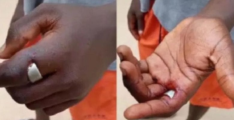 Ghana : Un Jeune Homme Vole La Bague Magique De Son Ami, Elle Lui Bouffe Le Doigt