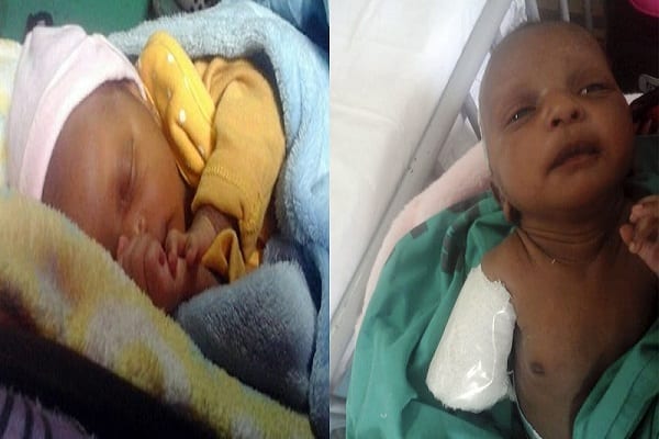 Horreur : Un Bébé D’un Mois Hospitalisé Pour Une Diarrhée Se Retrouve Avec Une Main Amputée, Sa Mère Inconsolable