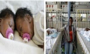 Des Bébés Siamois Séparés Avec Succès En Afrique Du Sud (Photos)