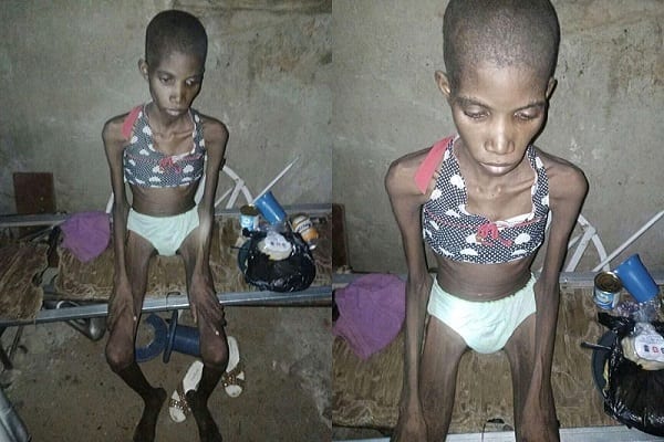 Nigeria : Une Fille De 12 Ans Enfermée Dans Une Cage Et Privée De Nourriture Pendant 8 Mois (Photos)