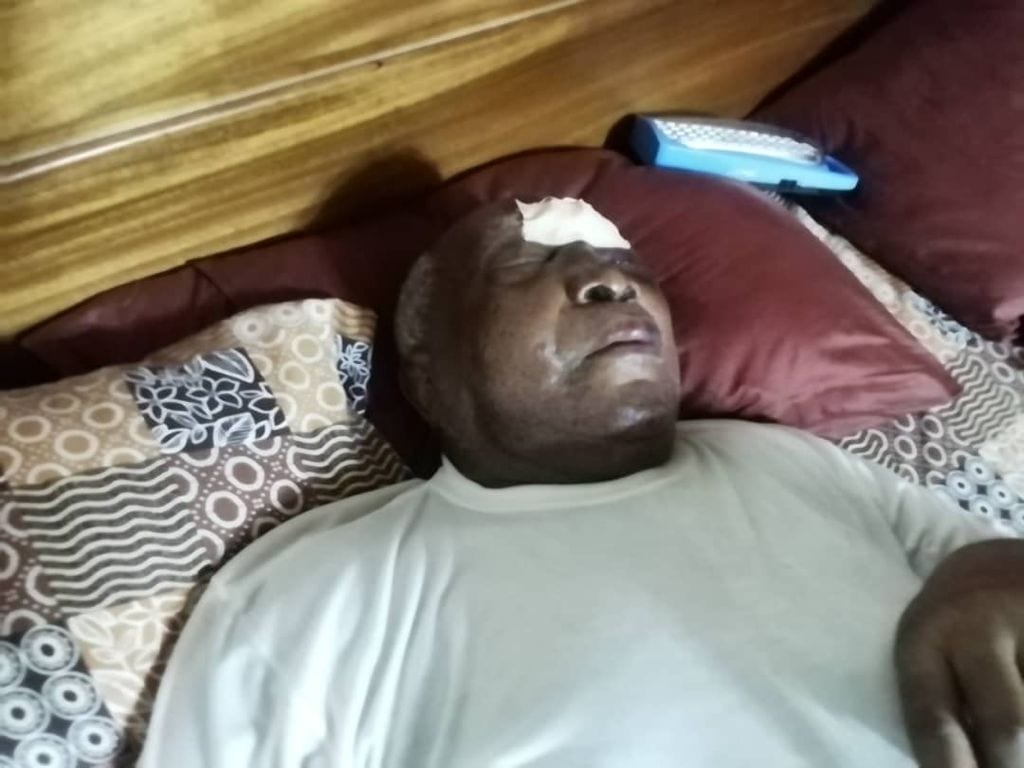 Graves blessures de Mgr Kpodzro, voici les révélations d’un proche d’Agbéyomé Kodjo