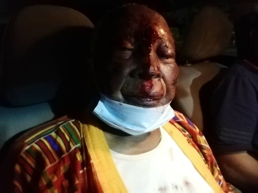 WhatsApp Image 2021 05 13 at 19.44.20 1 - Graves blessures de Mgr Kpodzro, voici les révélations d'un proche d'Agbéyomé Kodjo